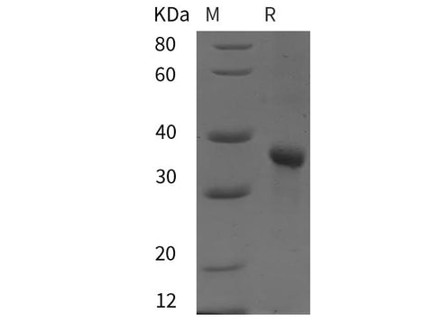 SDS-PAGE analysis of Human PTCH1 proteins, 2 μg/lane of Recombinant Human PTCH1 proteins was resolved with SDS-PAGE under reducing conditions, showing bands at 38 kDa.