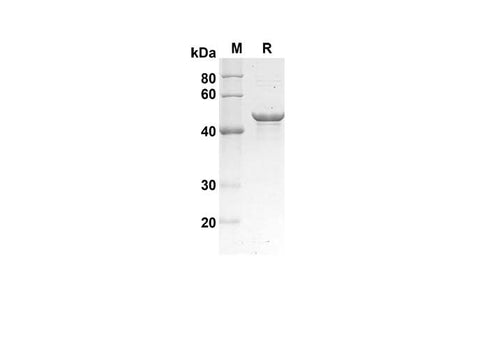 SDS-PAGE analysis of Human PTEN MMAC1 TEP1 proteins , 2 μg/lane of Recombinant Human PTEN MMAC1 TEP1 proteins was resolved with SDS-PAGE under reducing conditions , showing bands at 43 kDa.