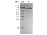 Recombinant Human PD-L1/B7-H1/CD274 Protein (Fc & Avi Tag) - ABMIUM