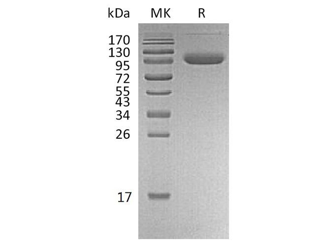 Recombinant Human PD-L1/B7-H1/CD274 Protein (Fc & Avi Tag) - ABMIUM