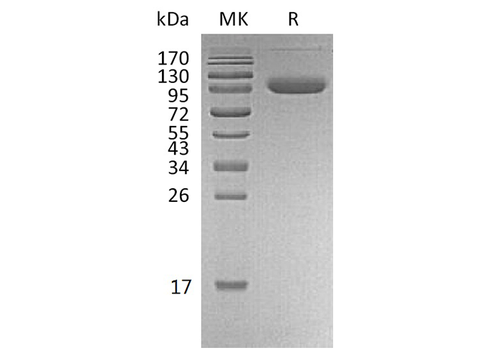 Recombinant Human PD-L1/B7-H1/CD274 Protein (Fc & Avi Tag) - ABMIUM