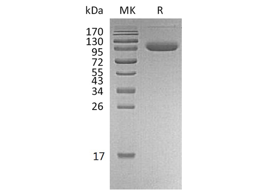 Recombinant Human PD-L1/B7-H1/CD274 Protein (Fc & Avi Tag) - ABMIUM