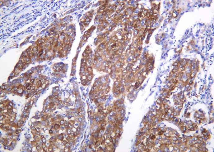 Anti-Human/Mouse/Rat Shh Antibody [B1012] - ABMIUM