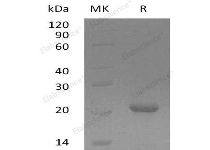 Recombinant Human GADD45γ/GADD45G Protein (His Tag) - ABMIUM