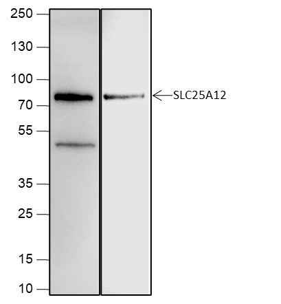Anti-Human/Rat/Mouse SLC25A12 Antibody [A655] - ABMIUM