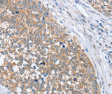 Anti-Human/Mouse PAPSS1 Antibody - ABMIUM