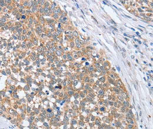 Anti-Human/Mouse PAPSS1 Antibody