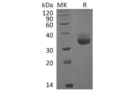 Recombinant Cynomolgus PD-L1/B7-H1/CD274 Protein (His Tag) - ABMIUM