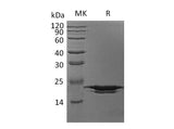 Recombinant Human PPIH Protein (His Tag) - ABMIUM