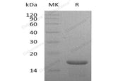 Recombinant Mouse Interleukin-21/IL-21 Protein (His Tag) - ABMIUM