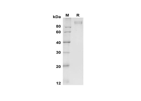 SDS-PAGE analysis of Mouse E-Selectin/CD62E proteins, 2 μg/lane of Recombinant Mouse E-Selectin/CD62E proteins was resolved with SDS-PAGE under reducing conditions, showing bands at 100-110 kDa.