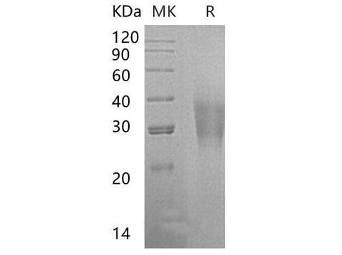 Recombinant Human CD300a/LMIR1 Protein (His Tag) - ABMIUM