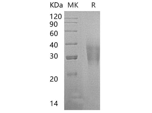 Recombinant Human CD300a/LMIR1 Protein (His Tag) - ABMIUM
