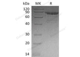 Recombinant Human Cadherin-11/CDH11 Protein (His Tag) - ABMIUM