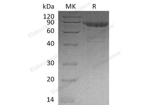 Recombinant Human Cadherin-11/CDH11 Protein (His Tag) - ABMIUM