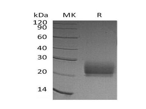 Recombinant Human KLRD1/CD94 Protein (His Tag) - ABMIUM