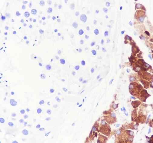 Anti-Human INSL3 Antibody [A607] - ABMIUM