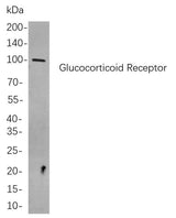 Anti-Human/Mouse/Rat Glucocorticoid Receptor Antibody [B753]