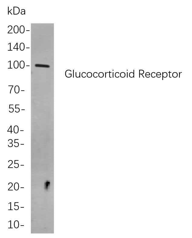 Anti-Human/Mouse/Rat Glucocorticoid Receptor Antibody [B753]