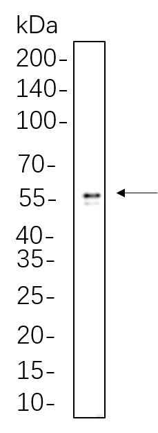 Anti-Human/Mouse/Rat ALDH1A1 Antibody [B650] - ABMIUM