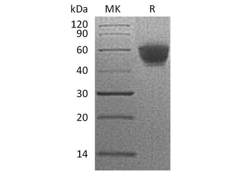 Recombinant Human NKG2D/CD314 Protein (Fc Tag) - ABMIUM