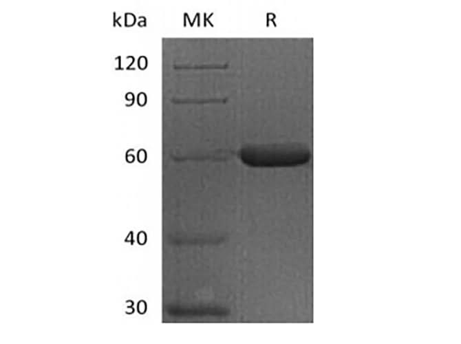 Recombinant Human FGL1 (C-Fc) - ABMIUM