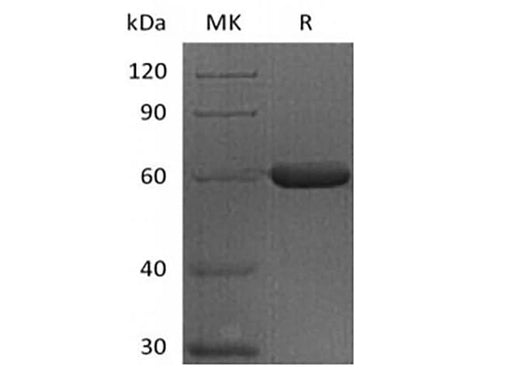 Recombinant Human FGL1 (C-Fc) - ABMIUM