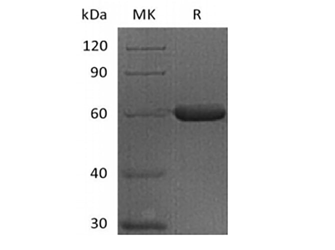 Recombinant Human FGL1 (C-Fc) - ABMIUM