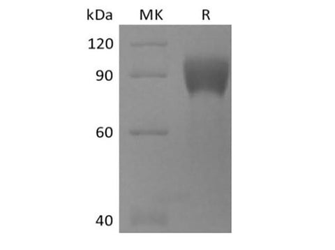 Recombinant Human TPBG/5T4 (C-mFc) - ABMIUM