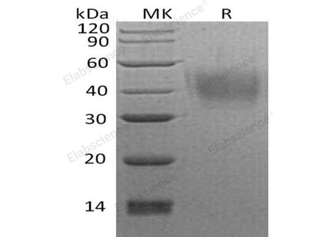 Recombinant Human Neuroplastin/NPTN Protein (His Tag) - ABMIUM