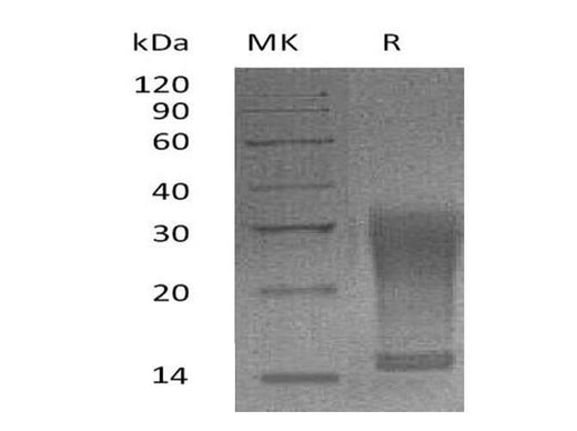 Recombinant Mouse Interleukin-13/IL-13 Protein (His Tag) - ABMIUM