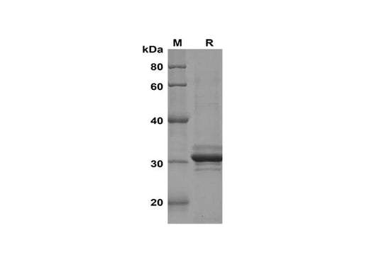 SDS-PAGE analysis of Human LC3A/B proteins, 2 μg/lane of Recombinant Human LC3A/B proteins was resolved with SDS-PAGE under reducing conditions, showing bands at 31 kDa.