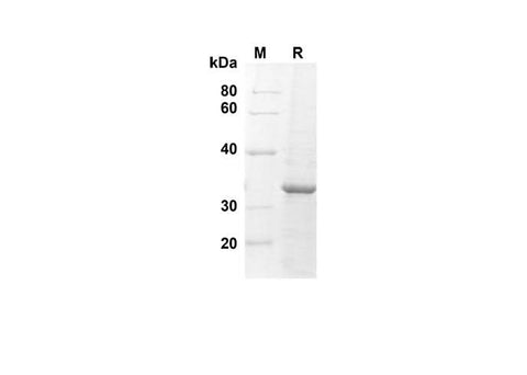 SDS-PAGE analysis of Human AGRP proteins, 2 μg/lane of Recombinant Human AGRP proteins was resolved with an SDS-PAGE under reducing conditions, showing bands at 32.2 kDa.