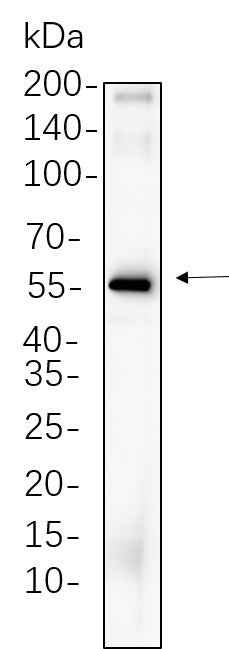 Anti-Human/Rat Cdc25C Antibody [B636] - ABMIUM