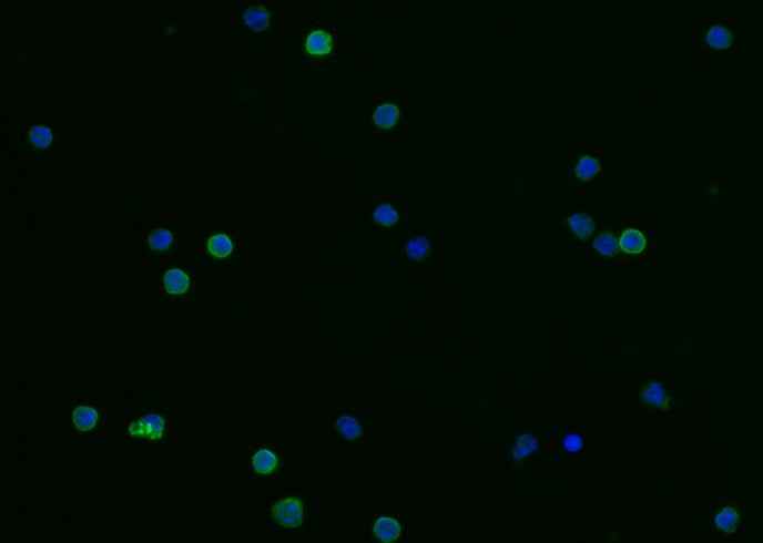 Anti-Mouse FCER2 Antibody [B477] - ABMIUM