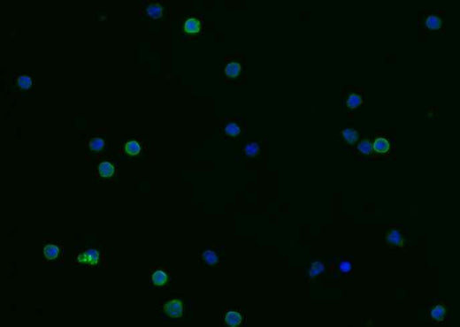 Anti-Mouse FCER2 Antibody [B477] - ABMIUM