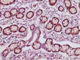 Anti-Human/Mouse/Rat Ki67 Antibody - ABMIUM