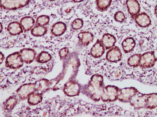 Anti-Human/Mouse/Rat Ki67 Antibody - ABMIUM