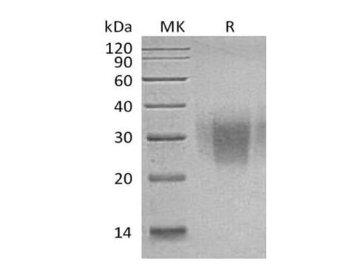 Recombinant Human PD-1/PDCD1 Protein (C93S Mutant, His Tag) - ABMIUM