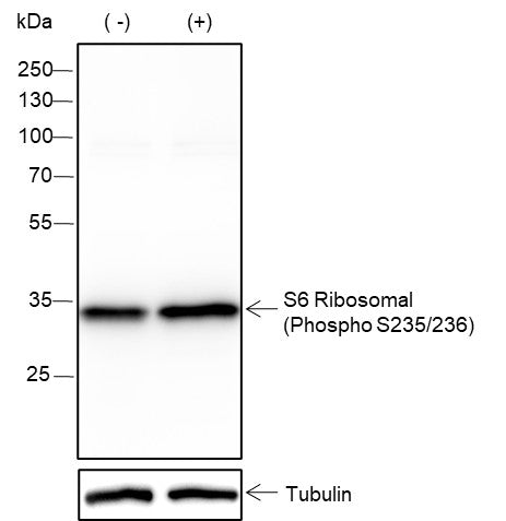 Anti-Human/Mouse Phospho-S6 Ribosomal Protein (Ser235, Ser236) Antibody [A796] - ABMIUM