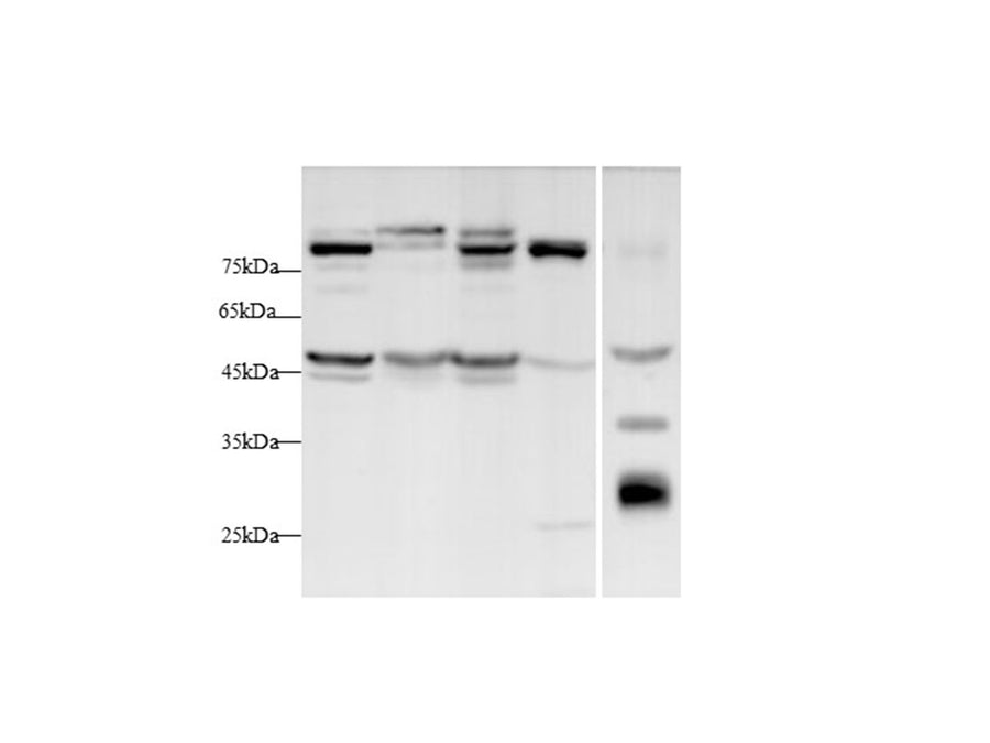 Anti-Human/Mouse/Rat Lbp Antibody - ABMIUM