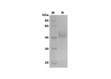 SDS-PAGE analysis of Human LRG1 proteins, 2 μg/lane of Recombinant Human LRG1 proteins was resolved with SDS-PAGE under reducing conditions, showing bands at 43 kDa.