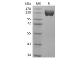 Recombinant Human ACE2 Protein (Fc Tag) - ABMIUM