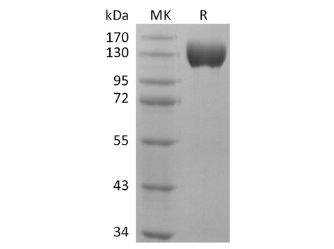 Recombinant Human ACE2 Protein (Fc Tag) - ABMIUM