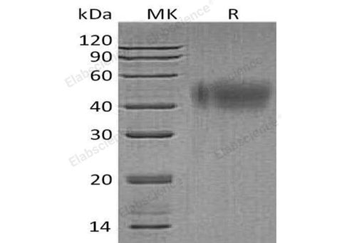 Recombinant Human IFNAR2 Protein (His Tag) - ABMIUM