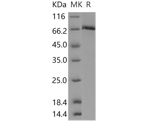 Recombinant Human c-MET/HGFR Protein (aa 956-1390, His & GST Tag) - ABMIUM