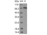 Recombinant Human c-MET/HGFR Protein (aa 956-1390, His & GST Tag) - ABMIUM