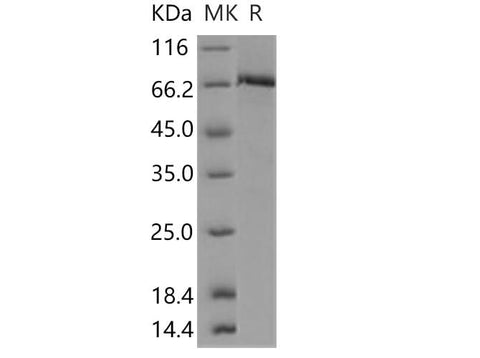 Recombinant Human c-MET/HGFR Protein (aa 956-1390, His & GST Tag) - ABMIUM
