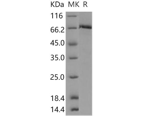 Recombinant Human c-MET/HGFR Protein (aa 956-1390, His & GST Tag) - ABMIUM