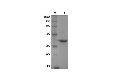 SDS-PAGE analysis of Human IL-17A proteins, 2 μg/lane of Recombinant Human IL-17A proteins was resolved with SDS-PAGE under reducing conditions, showing bands at 35 kDa.